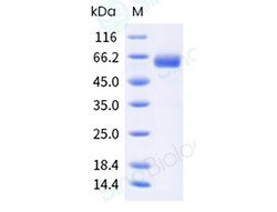 Sino Biological Recombinant Human IGSF11 Protein (ECD, hFc Tag), HPLC-verified,