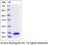 Sino Biological Recombinant Human IL-20 Protein, Quantity: Each of 1
