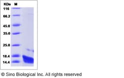 Sino Biological Recombinant Human IL-22 Protein, Quantity: Each of 1