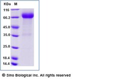 Sino Biological Recombinant Human KIR2DL3 Protein (ECD, hFc Tag), Quantity:
