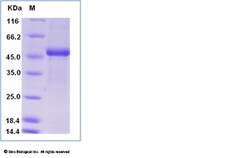Sino Biological Recombinant Human GPX7 Protein (hFc Tag), Quantity: Each