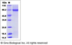 Sino Biological Recombinant Human Alkaline Phosphatase/PLAP/ALPP Protein