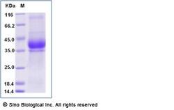 Sino Biological Recombinant Human KLK15 Protein (His Tag), Quantity: Each