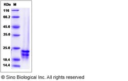 Sino Biological Recombinant Human FGF-17 Protein, Quantity: Each of 1