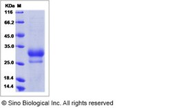 Sino Biological Recombinant Human IL-29/IFN-lambda 1 Protein, Quantity: