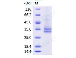 Sino Biological Human A2aR-Nanodisc Protein (His & Flag Tag, thermostabilizing
