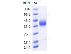 Sino Biological Recombinant Human CD47 Protein (His & AVI Tag), Biotinylated,