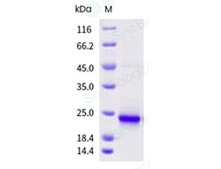 Sino Biological Recombinant Human KRAS Protein (His Tag), Quantity: Each