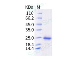 Sino Biological Recombinant Human KRAS Protein (61Q, His Tag), HPLC-verified,