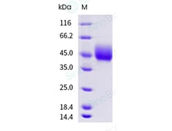 Sino Biological Recombinant Human Siglec-3/CD33 Protein (ECD, His Tag),