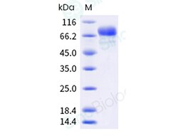 Sino Biological Recombinant Human Siglec-3/CD33 Protein (ECD, hFc Tag),