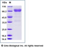 Sino Biological Recombinant Human VSIG4 Protein (hFc Tag), Amine-Labeled