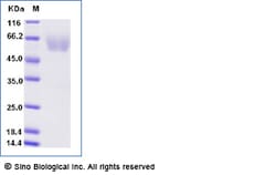 Sino Biological Recombinant Human Tim4/TIMD4 Protein (His Tag), Amine-Labeled