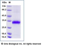 Sino Biological Recombinant Human KSP37/FGFBP2 Protein (His Tag), Quantity: