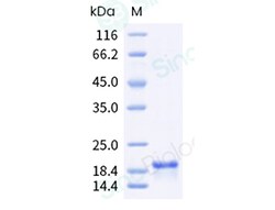 Sino Biological Recombinant Human alpha-Synuclein Protein, Quantity: Each