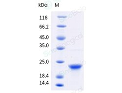 Sino Biological Recombinant Human alpha-Synuclein Protein (His & AVI Tag),