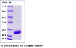 Sino Biological Recombinant Human Ephrin A4 Protein (His Tag), Quantity: