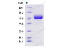 Sino Biological Recombinant Human GLA/alpha-Galactosidase A Protein (His