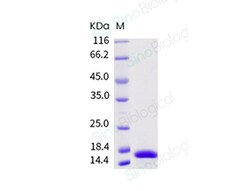 Sino Biological Recombinant Human IL-17A Protein, Quantity: Each of 1