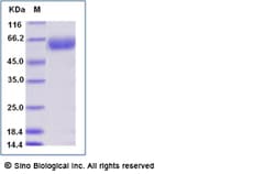Sino Biological Recombinant Human ILT5/LILRB3 Protein (ECD, His Tag), HPLC-verified,