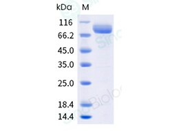 Sino Biological Recombinant Human LRP-6 Protein (His & AVI Tag), Biotinylated,