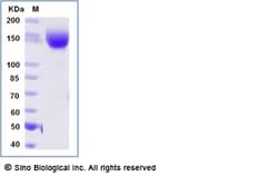 Sino Biological Recombinant Human Siglec-2/CD22 Protein (ECD, hFc & AVI