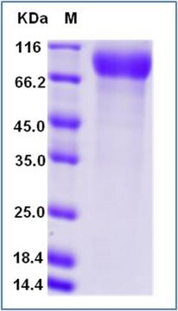 Sino Biological Recombinant Human Siglec-2/CD22 Protein (aa 176-687, His