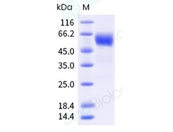 Sino Biological Recombinant Human BTLA Protein (hFc & AVI Tag), Biotinylated,