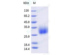 Sino Biological Recombinant Human BTLA Protein (His Tag), HPLC-verified,