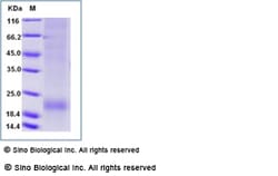 Sino Biological Recombinant Human IL-17F Protein (His Tag), Amine-Labeled