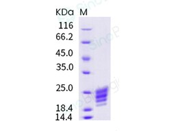 Sino Biological Recombinant Human IL-9 Protein (His Tag), Quantity: Each