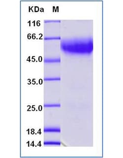 Sino Biological Recombinant Human L-selectin/CD62L Protein (ECD, His Tag),