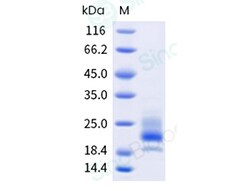 Sino Biological Recombinant Human M-CSF/CSF1 Protein, HPLC-verified, Quantity: