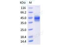 Sino Biological Recombinant Human M-CSF/CSF1 Protein (His & AVI Tag), Biotinylated,