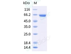 Sino Biological Recombinant Human Munc18-1/STXBP1 Protein, Quantity: Each