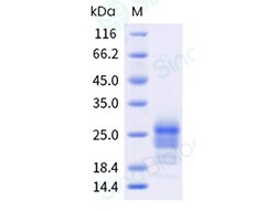 Sino Biological Recombinant Human IFN gamma Protein (His Tag), HPLC-verified,