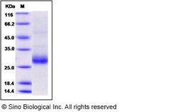 Sino Biological Recombinant Human RANKL/TNFSF11 Protein, MALS-verified,