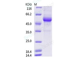 Sino Biological Recombinant Human RANKL/TNFSF11 Protein (ECD, hFc Tag),