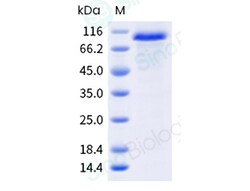 Sino Biological Recombinant Human DLL1 Protein (ECD, hFc Tag), HPLC-verified,
