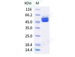 Sino Biological Recombinant Human RAGE Protein (His & AVI Tag), Biotinylated,