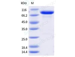 Sino Biological Recombinant Human RAGE Protein (hFc & AVI Tag), Biotinylated,