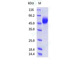 Sino Biological Recombinant Human SIRP alpha/SHPS-1 Protein (G75A, ECD,