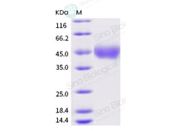 Sino Biological Recombinant Human Neuregulin-1/NRG1 Protein (ECD), Amine-Labeled