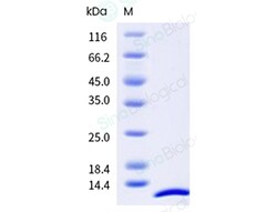 Sino Biological Recombinant Human Neuregulin-1/NRG1 Protein (ECD), HPLC-verified,