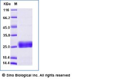 Sino Biological Recombinant Human Placental Lactogen/CSH1 Protein (His
