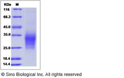 Sino Biological Recombinant Human IL-31 Protein (His Tag), Quantity: Each