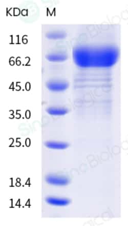 Sino Biological Recombinant Human IL-21 Receptor/IL-21R Protein (hFc Tag),