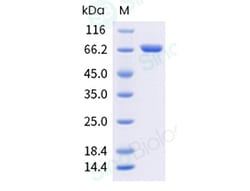 Sino Biological Recombinant Human beta-Catenin Protein (His Tag), HPLC-verified,