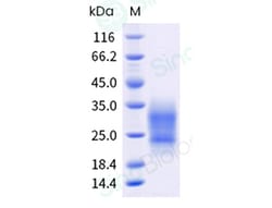 Sino Biological Recombinant Human CD63 Protein (His & AVI Tag), Biotinylated,