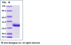 Sino Biological Recombinant Human C-Reactive Protein Protein, Amine-Labeled